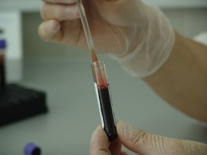 Blood in a test tube