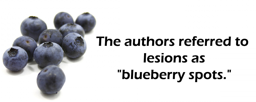 Blueberries with text that reads "the authors referred to lesions as blueberry spots."