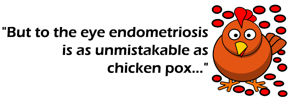 A chicken with text that reads "But to the eye endometriosis is as unmistakable as chicken pox..."