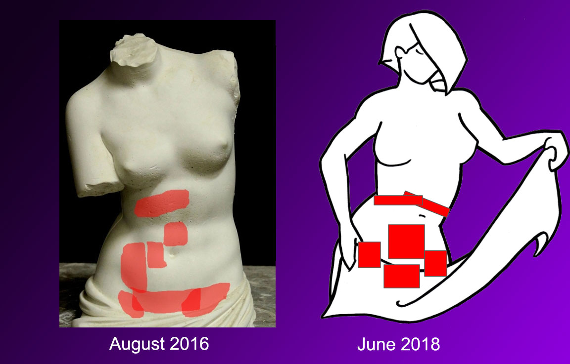A diagram comparing pain from August 2016 to June 2018