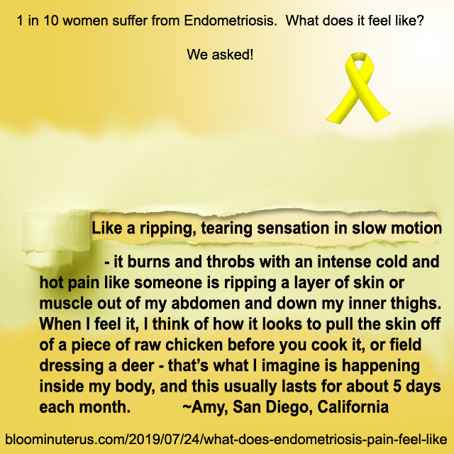 It feels like a ripping, tearing sensation in slow motion - it burns and throbs with an intense cold and hot pain like someone is ripping a layer of skin or muscle out of my abdomen and down my inner thighs. When I feel it, I think of how it looks to pull the skin off of a piece of raw chicken before you cook it, or field dressing a deer - that’s what I imagine is happening inside my body, and this usually lasts for about 5 days each month.  Amy, San Diego, California