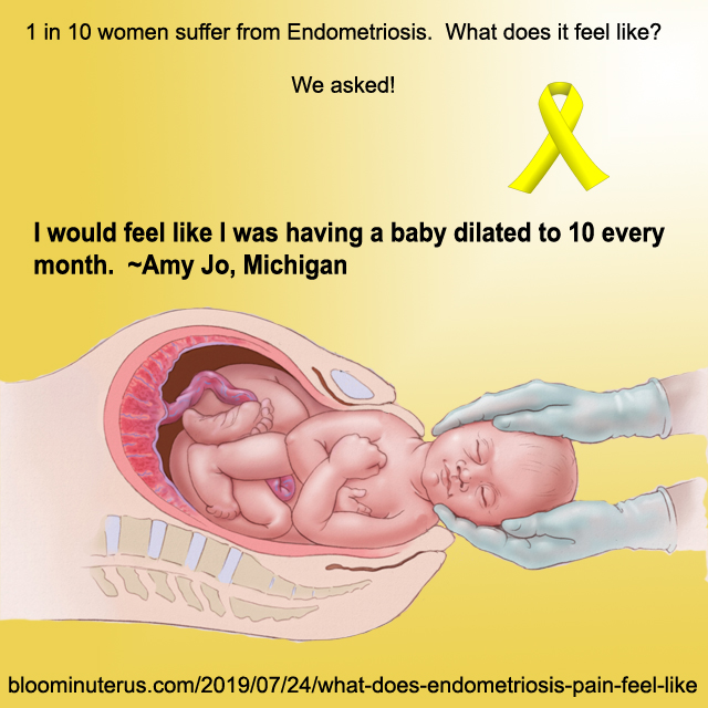 I would feel like I was having s baby dilated to 10 every month. Amy Jo, Michigan
