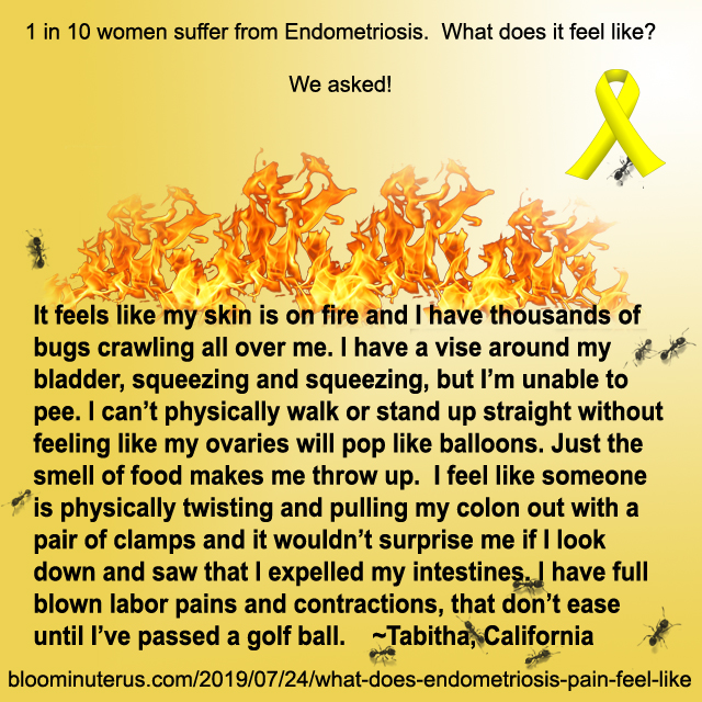 It feels like my skin is on fire and I have thousands of bugs crawling all over me. I have a vise around my bladder, squeezing and squeezing, but I’m unable to pee. I can’t physically walk or stand up straight without feeling like my ovaries will pop like balloons. Just the smell of food makes me throw up.  I feel like someone is physically twisting and pulling my colon out with a pair of clamps and it wouldn’t surprise me if I look down and saw that I expelled my intestines. I have full blown labor pains and contractions, that don’t ease until I’ve passed a golf ball.  Tabitha, California