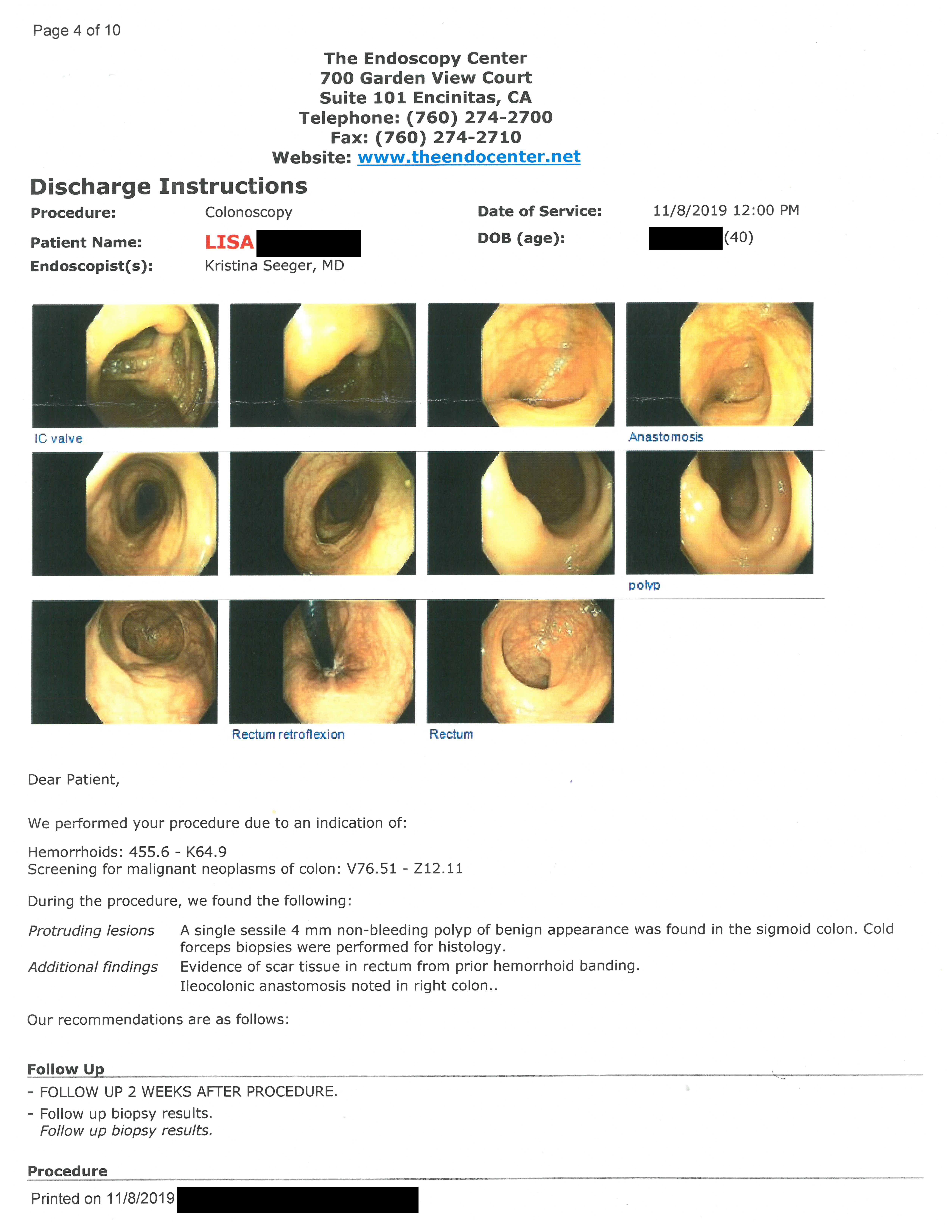 Colonoscopy photos of my guts