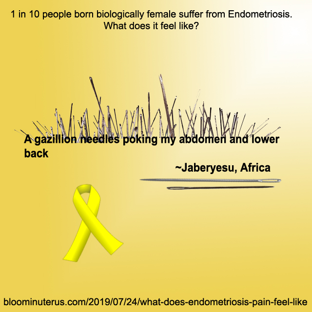 A gazillion needles poking my abdomen and lower back