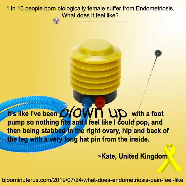 It's like I've been blown up with a foot pump so nothing fits and I feel like I could pop, and then being stabbed in the ovary, hip and back of the leg with a very long hat pin from the inside.